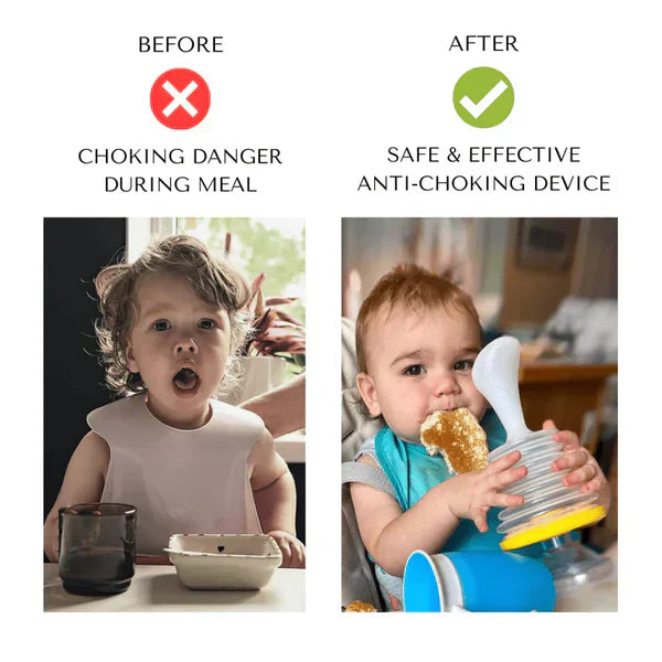 Gomartt™ ANTI-CHOKING DEVICE